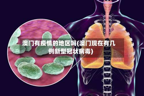 澳门有疫情的地区吗(澳门现在有几例新型冠状病毒)-第3张图片